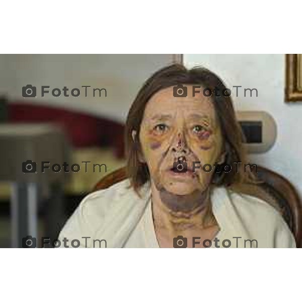 Tiziano Manzoni/Lapresse 9-2-2026 Bergamo Romano Di Lombardia Santina Farina aggredita a scopo di rapina