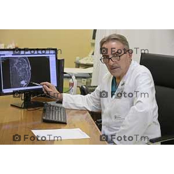 Bergamo Privato Fenaroli è un chirurgo senologo di esperienza pluridecennale, 27 Marzo 2026 Bergamo Italia foto Tiziano Manzoni Lapresse