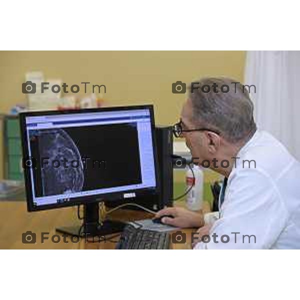 Bergamo Privato Fenaroli è un chirurgo senologo di esperienza pluridecennale, 27 Marzo 2026 Bergamo Italia foto Tiziano Manzoni Lapresse