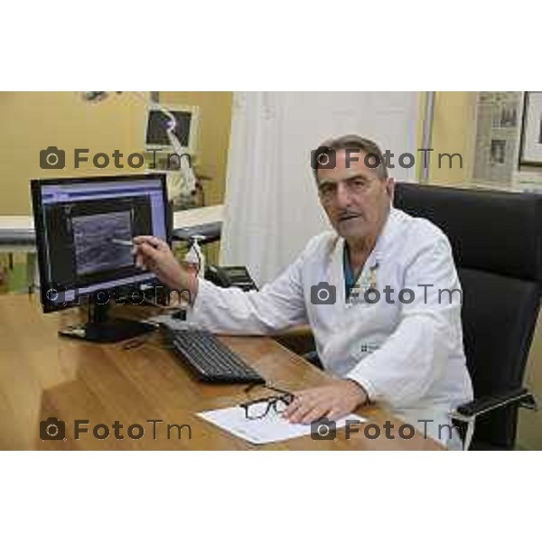 Bergamo Privato Fenaroli è un chirurgo senologo di esperienza pluridecennale, 27 Marzo 2026 Bergamo Italia foto Tiziano Manzoni Lapresse